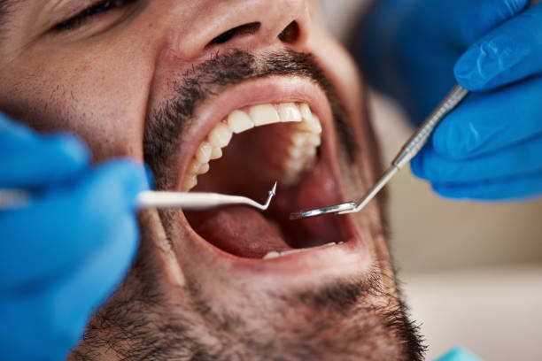 Best Emergency Gum Treatment in Spring Lake Heights, NJ